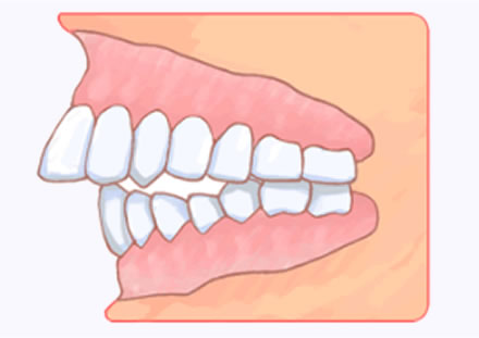 矯正歯科について