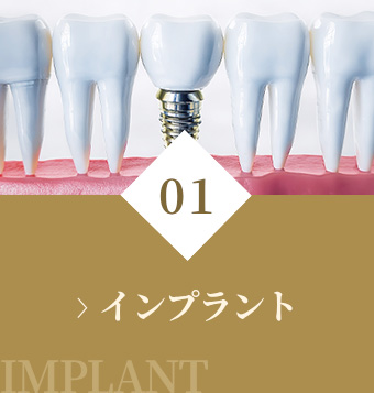 インプラント